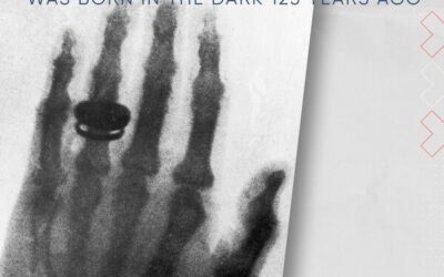 X-Rays: This invisible diagnostic light was born in the dark 125 years ago